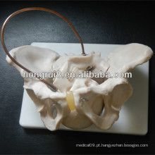 Modelo de pelvis fêmea ISO com crânio fetal, simulador de parto